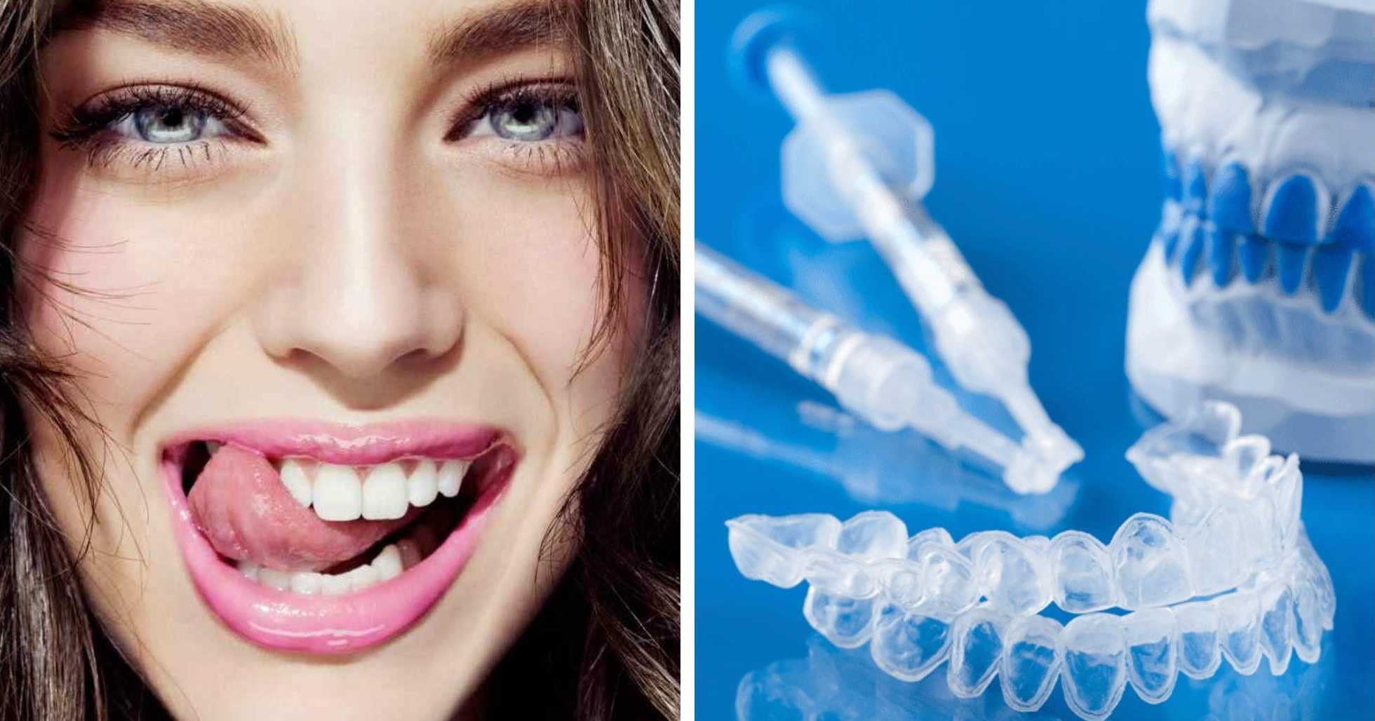 Отбеливание зубов нужно или нет днс зубная щетка oral b электрическая купить