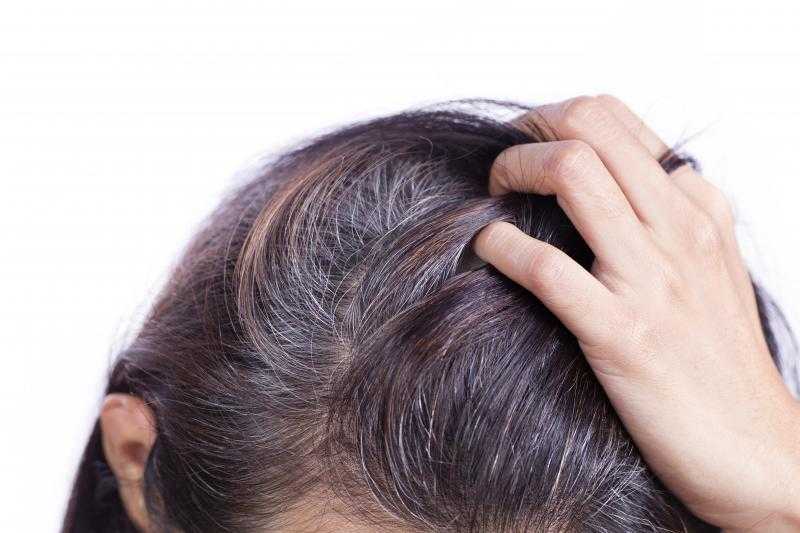 Лечение волос и кожи головы