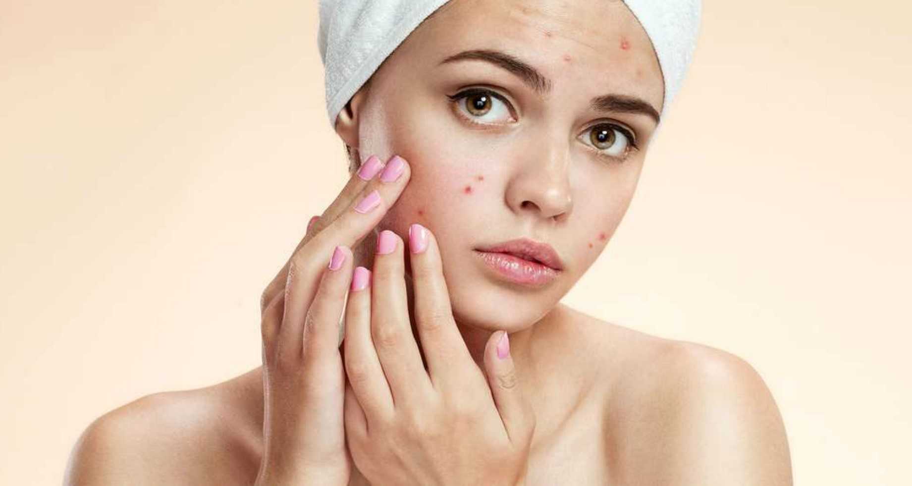 Как убрать и избавиться от шрамов после прыщей и рубцов на лице и коже: эффективные лучшие средства для удаления, чем можно лечить и что поможет вылечить