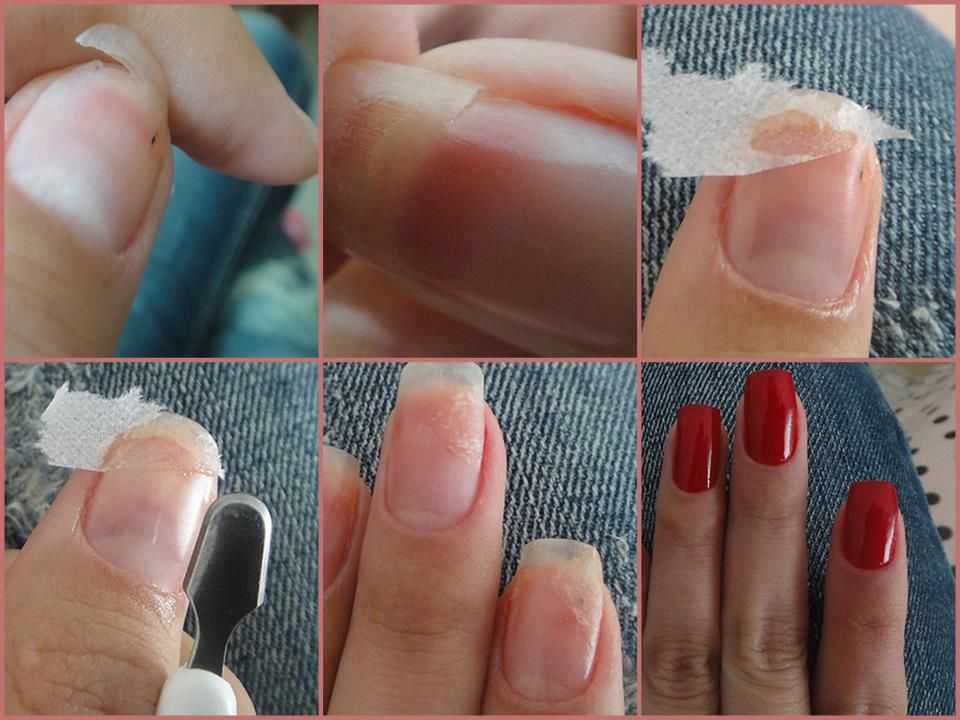Что можно сделать если сломался ноготь • журнал nails