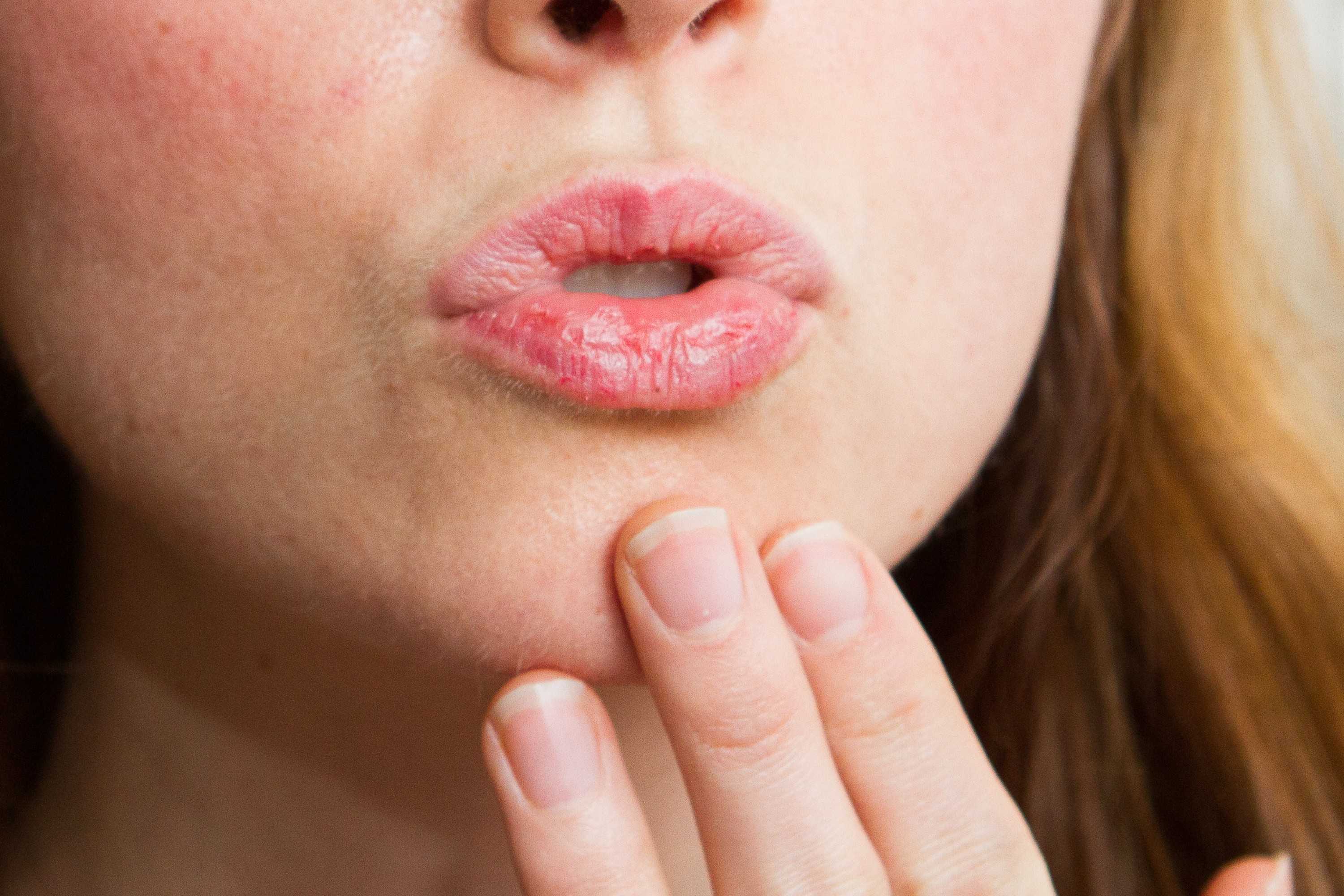 Как избежать трещин на губах? уход за сухими губами