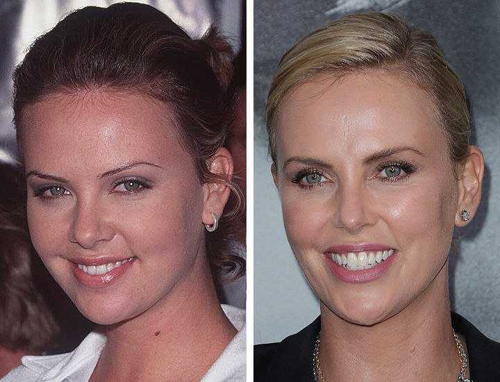 Красивые зубы фото до и после