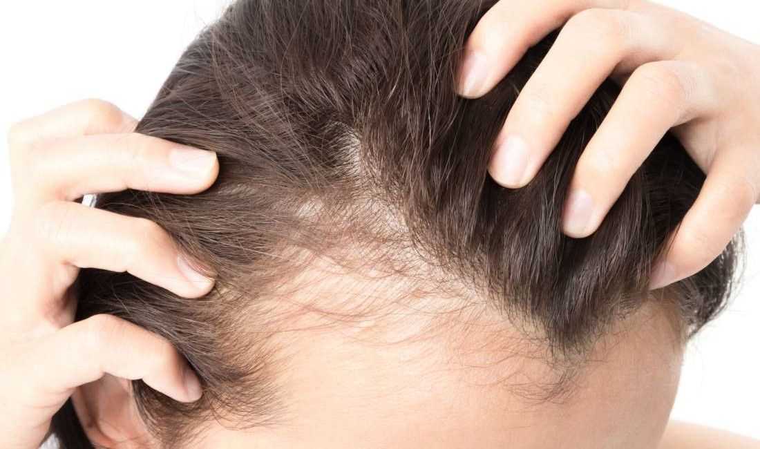 Лечение ломких волос – публикации – лаборатория ан-тек