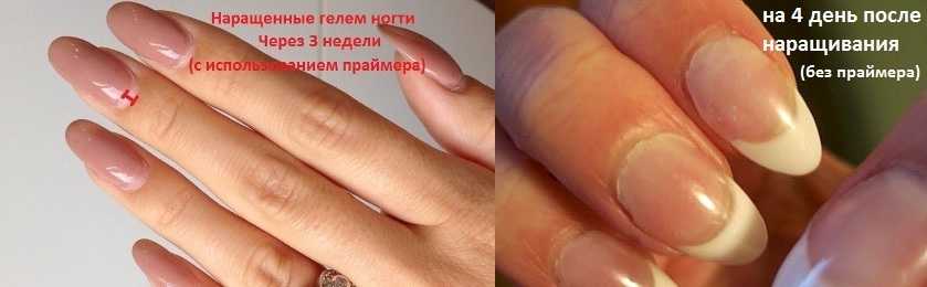 Популярные способы наращивания ногтей. их плюсы и минусы.