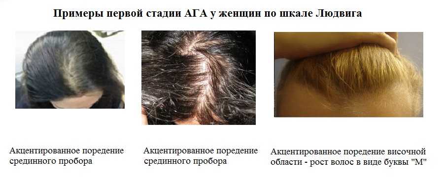 Здоровье и красота волос – грамотный уход - советы специалистов.