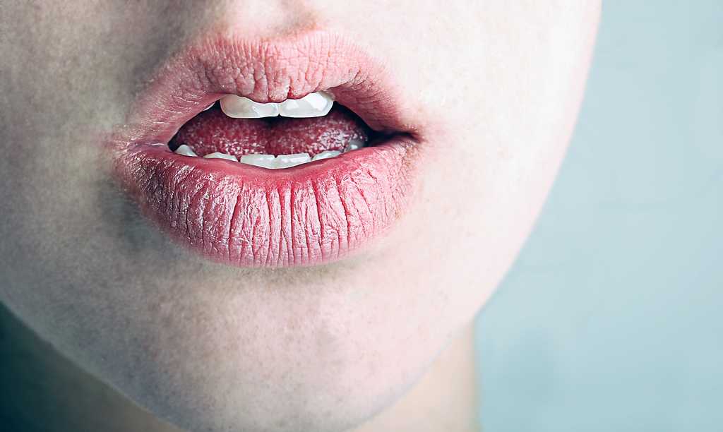 Почему сохнут губы у женщин: причины
