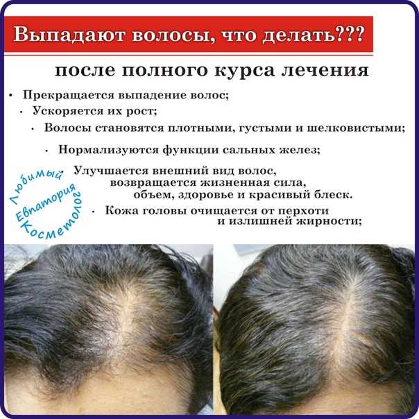 Волосы как маркер старения организма :: врачам-специалистам